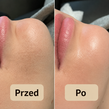 Peel Shot – Peeling usuwający zanieczyszczenia i poprawiający wygląd skóry