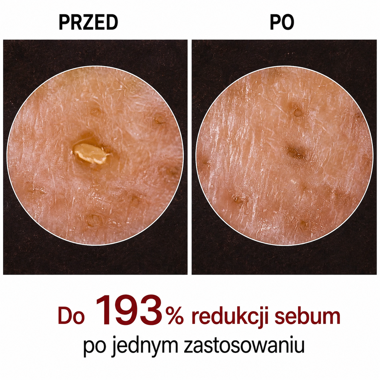 Peel Shot – Peeling usuwający zanieczyszczenia i poprawiający wygląd skóry